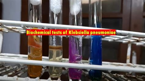 klebsiella biochemical test|Iba pa.